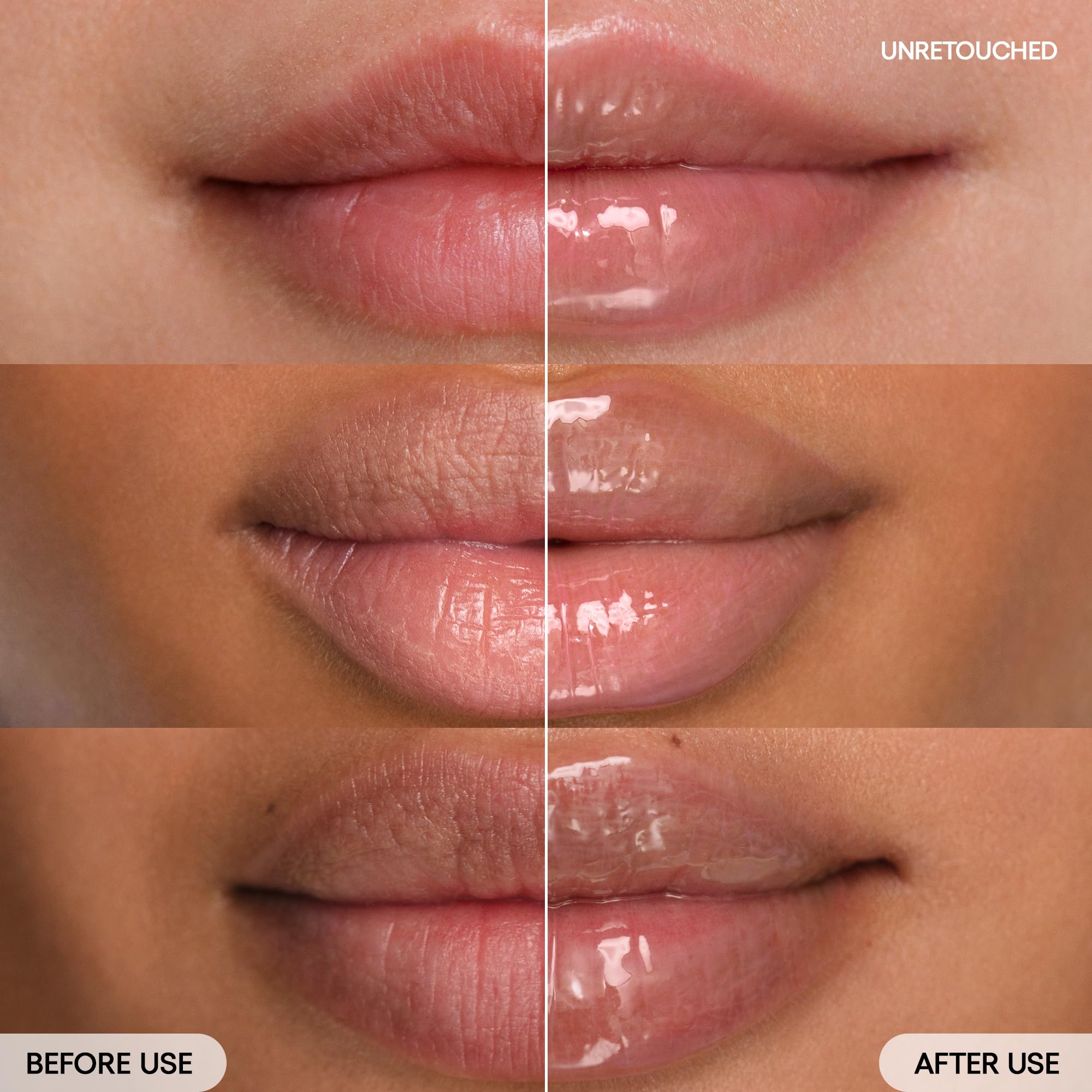 vitamin c and lip filler Best Serum dark spots Vitamin C Firming Serum with